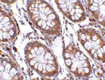 Anti-CCK4 antibody used in IHC (Paraffin sections) (IHC-P). GTX31321