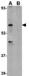 Anti-TRIM25 antibody used in Western Blot (WB). GTX31323