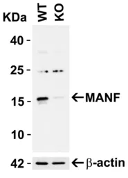 Anti-ARMET antibody used in Western Blot (WB). GTX31324
