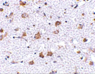 Anti-ARMET antibody used in IHC (Paraffin sections) (IHC-P). GTX31324