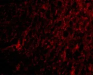 Anti-ARMET antibody used in IHC (Paraffin sections) (IHC-P). GTX31325