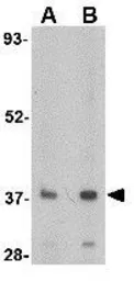Anti-FBXL20 antibody used in Western Blot (WB). GTX31331