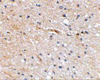 Anti-FBXL20 antibody used in IHC (Paraffin sections) (IHC-P). GTX31331