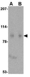 Anti-SLITRK1 antibody used in Western Blot (WB). GTX31332