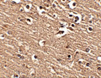 Anti-SLITRK1 antibody used in IHC (Paraffin sections) (IHC-P). GTX31332