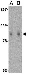 Anti-SLITRK1 antibody used in Western Blot (WB). GTX31333