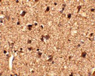 Anti-SLITRK1 antibody used in IHC (Paraffin sections) (IHC-P). GTX31333