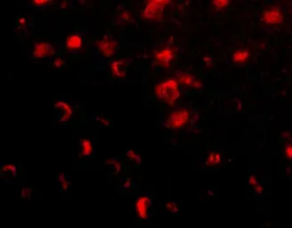 Anti-SLITRK1 antibody used in IHC (Paraffin sections) (IHC-P). GTX31333