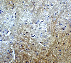 Anti-SLITRK1 antibody used in IHC (Paraffin sections) (IHC-P). GTX31333
