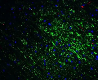 Anti-SLITRK1 antibody used in IHC (Paraffin sections) (IHC-P). GTX31333