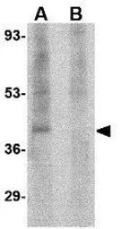 Anti-RIMS3 antibody used in Western Blot (WB). GTX31334