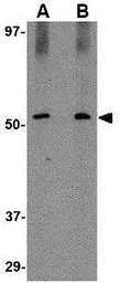 Anti-SIRT2 antibody used in Western Blot (WB). GTX31335
