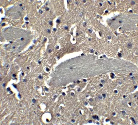 Anti-NP2 antibody used in IHC (Paraffin sections) (IHC-P). GTX31338