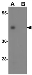 Anti-NP2 antibody used in Western Blot (WB). GTX31338