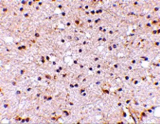 Anti-NP2 antibody used in IHC (Paraffin sections) (IHC-P). GTX31338