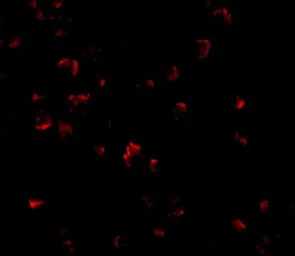 Anti-GRTP1 antibody used in Immunocytochemistry/ Immunofluorescence (ICC/IF). GTX31339