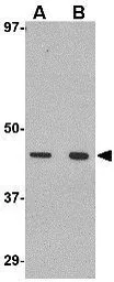 Anti-Wnt10a antibody used in Western Blot (WB). GTX31345