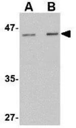 Anti-LASS5 antibody used in Western Blot (WB). GTX31350