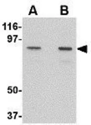 Anti-NUP107 antibody used in Western Blot (WB). GTX31352