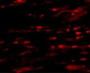 Anti-ASAH1 antibody used in IHC (Paraffin sections) (IHC-P). GTX31356