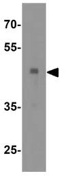 Anti-ASAH1 antibody used in Western Blot (WB). GTX31356