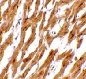 Anti-ASAH1 antibody used in IHC (Paraffin sections) (IHC-P). GTX31356