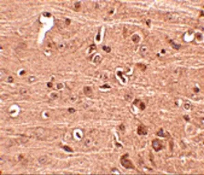 Anti-GLE1 antibody used in IHC (Paraffin sections) (IHC-P). GTX31366