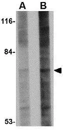 Anti-GLE1 antibody used in Western Blot (WB). GTX31368