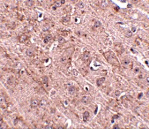 Anti-GLE1 antibody used in IHC (Paraffin sections) (IHC-P). GTX31368