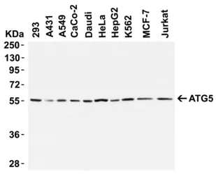 Anti-ATG5 antibody used in Western Blot (WB). GTX31372