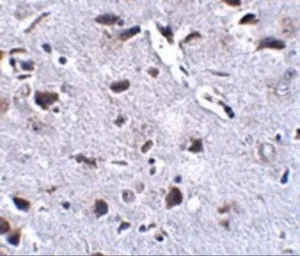 Anti-RCAN2 antibody used in IHC (Paraffin sections) (IHC-P). GTX31373
