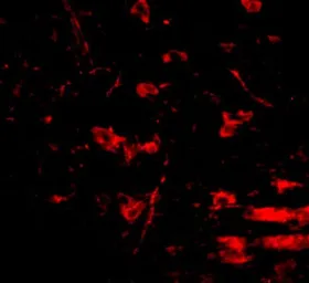 Anti-RCAN2 antibody used in IHC (Paraffin sections) (IHC-P). GTX31373