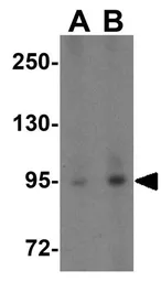 Anti-TNFAIP3 antibody used in Western Blot (WB). GTX31378