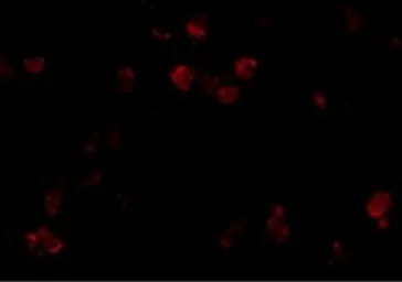 Anti-CD81 antibody used in Immunocytochemistry/ Immunofluorescence (ICC/IF). GTX31381