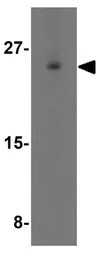 Anti-CD81 antibody used in Western Blot (WB). GTX31381