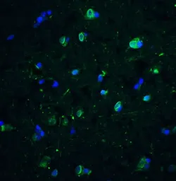 Anti-CD81 antibody used in IHC (Paraffin sections) (IHC-P). GTX31381