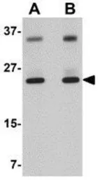 Anti-THEM4 antibody used in Western Blot (WB). GTX31383