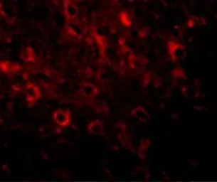 Anti-FAM120A antibody used in IHC (Paraffin sections) (IHC-P). GTX31385
