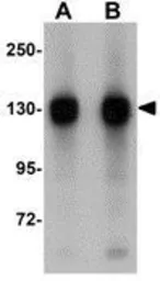 Anti-FAM120A antibody used in Western Blot (WB). GTX31385