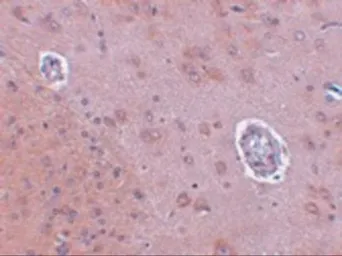 Anti-FAM120A antibody used in IHC (Paraffin sections) (IHC-P). GTX31385