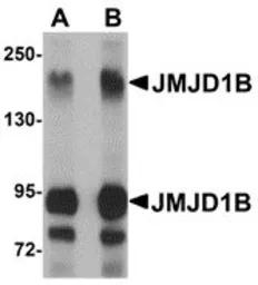 Anti-KDM3B antibody used in Western Blot (WB). GTX31386