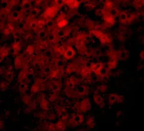 Anti-KDM3B antibody used in IHC (Paraffin sections) (IHC-P). GTX31386