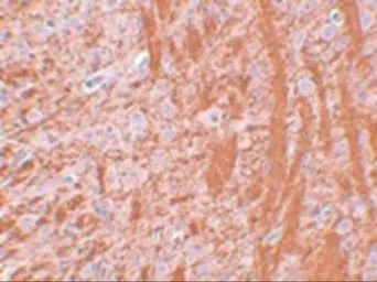 Anti-PSR antibody used in IHC (Paraffin sections) (IHC-P). GTX31387