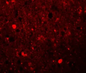 Anti-SRPX antibody used in IHC (Paraffin sections) (IHC-P). GTX31394
