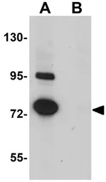 Anti-SRPX antibody used in Western Blot (WB). GTX31394