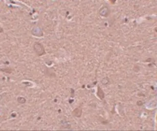 Anti-SRPX antibody used in IHC (Paraffin sections) (IHC-P). GTX31394