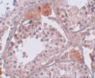 Anti-NYD-SP26 antibody used in IHC (Paraffin sections) (IHC-P). GTX31395