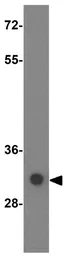 Anti-SGK493 antibody used in Western Blot (WB). GTX31396
