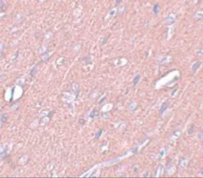 Anti-Synaptogyrin 3 antibody used in IHC (Paraffin sections) (IHC-P). GTX31397