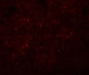 Anti-Synaptogyrin 3 antibody used in IHC (Paraffin sections) (IHC-P). GTX31397